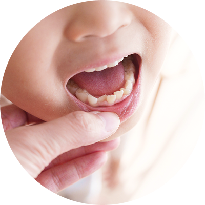 子供の歯並びを確認する様子