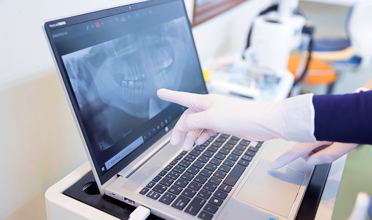 歯のレントゲン